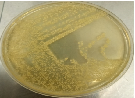 Figure 3: Most Prevalent Bacteria among Non-Smokers and Smokers.