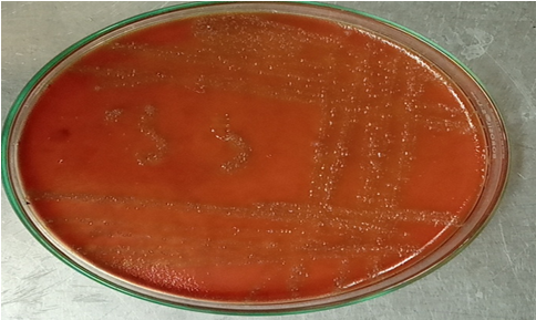 Figure 5: Colony Morphology of Streptococcus Spp. Blood Agar.