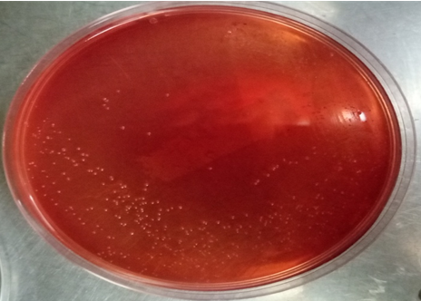 Figure 6: Colony Morphology of _K. Pneumoniae_ on Macconkey Agar.