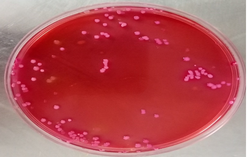 Figure 7: Colony Morphology of _E. Coli_ on Macconkey Agar.