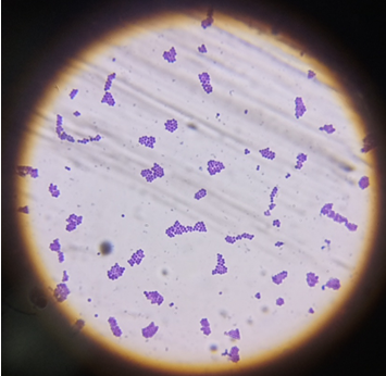 Figure 8: Gram staining and microscopy of _S. aureus._