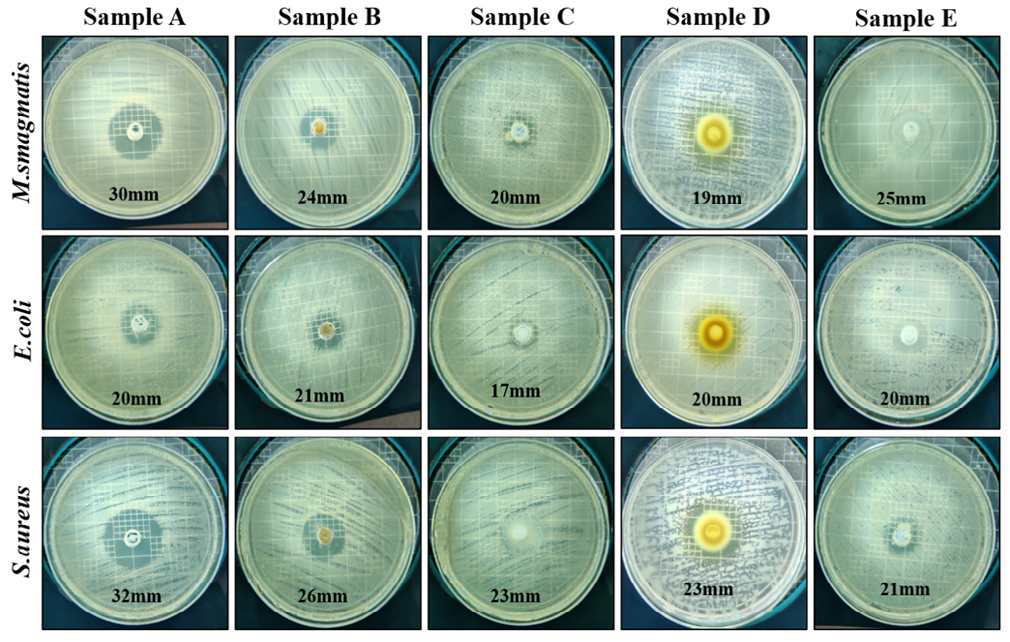 Figure 6: Caeinase and Protease activity of synthesized Bio-enzymes.