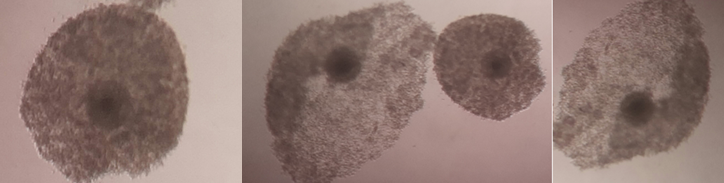 Figure 4: Fully expanded COCs matured on BO-IVM media.
