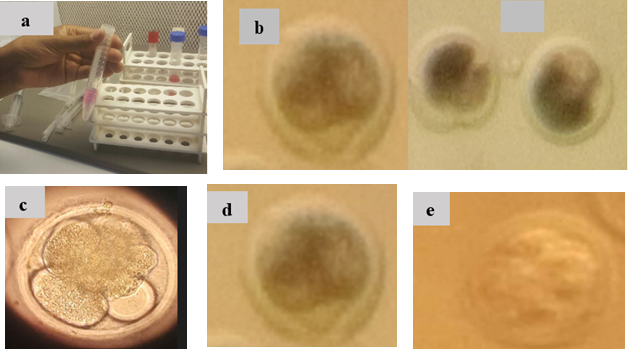 Figure 6: Fertilized COCs at different developmental stages (cell). a) sperm preparation technique, b) two-cell embryo c) four-cell embryo d) eight-cell embryo e) early morula embryo. Regardless of the type of breed and media used, the overall fertilization/cleavage rates for the inseminated COCs were 36.6% (154/421). The fertilization and cleavage rate of COCs for both Boran and Boran*Holistein Friesian crossbred were indicated in Figure 4. The current findings indicated that, compared to TCM-199 IVF media, BO-IVF media, which is complete and readymade, were cleaved and fertilized significantly (p<0.05).