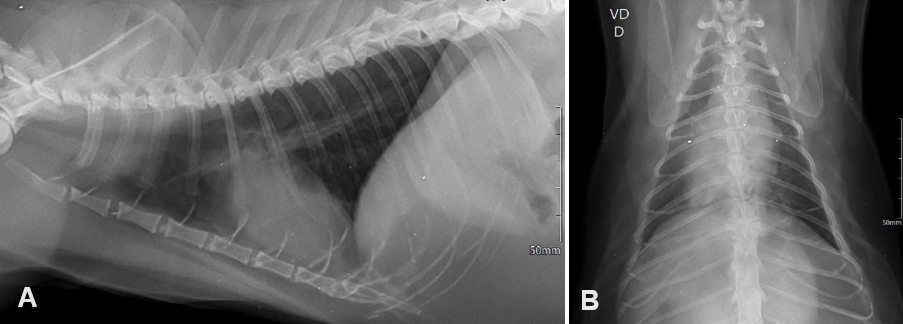 Figure 3: Chest X-ray.