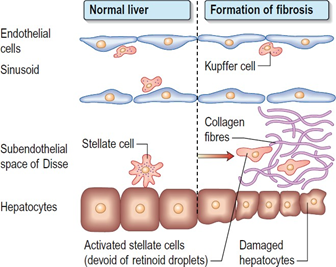 Figure 1: Pathogenesis of fibrosis [16].