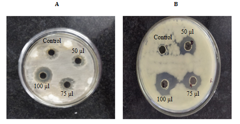 Figure 3: Antifungal activity of chitosan at different concentrations on zone of inhibition in various fungal species tested. Data represents mean of triplicate repeats of three determinations (mean ± SD).