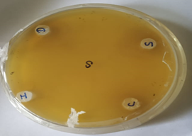 Figure 6: Antibacterial activity of Streptococcus sp. against the probiotic strains.