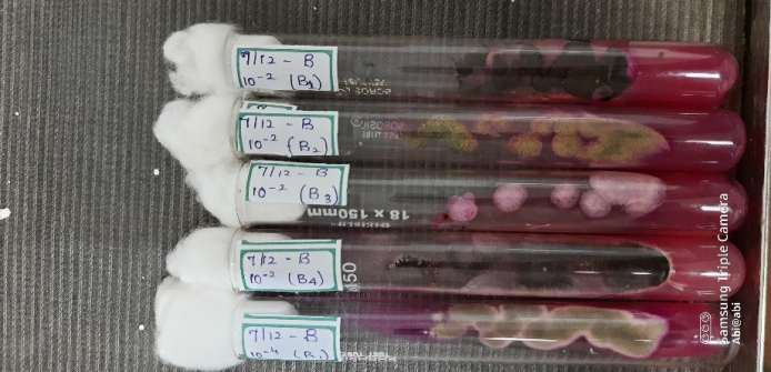 Figure 11: Pure Cultures of Sample B.