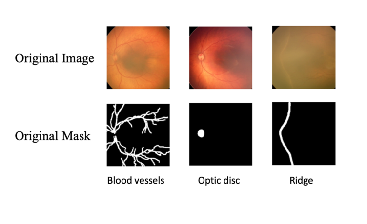 Figure 1: Original Images and their Associated Manually Delineated Segmentation Masks.