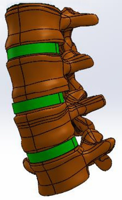 Figure 1: Finite Element Model.