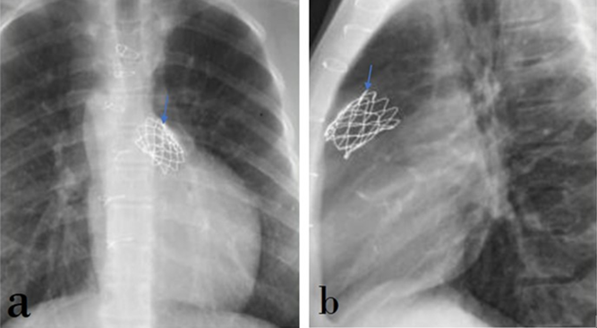 Figure 10