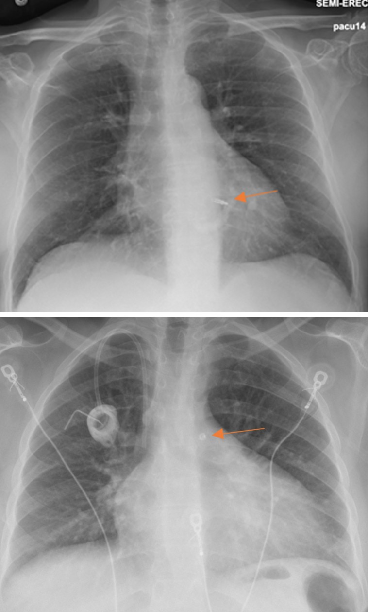 Figure 15