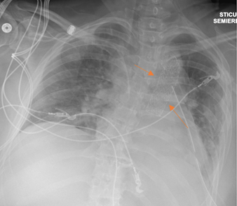 Figure 18