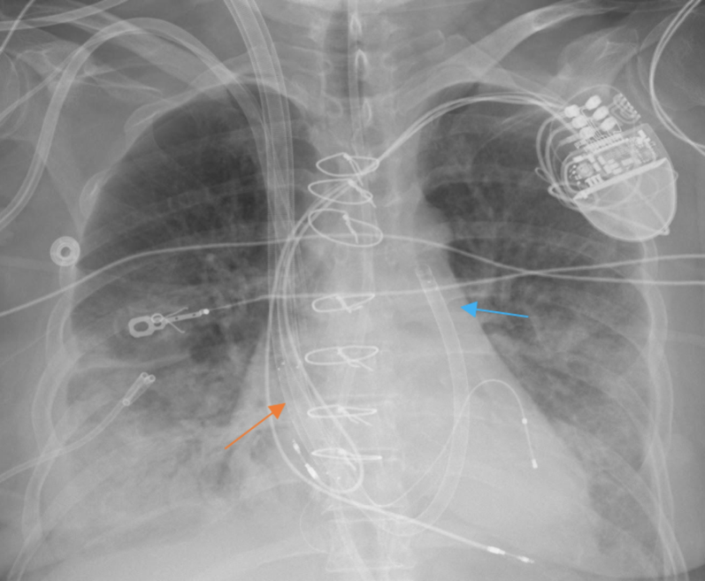 Figure 22