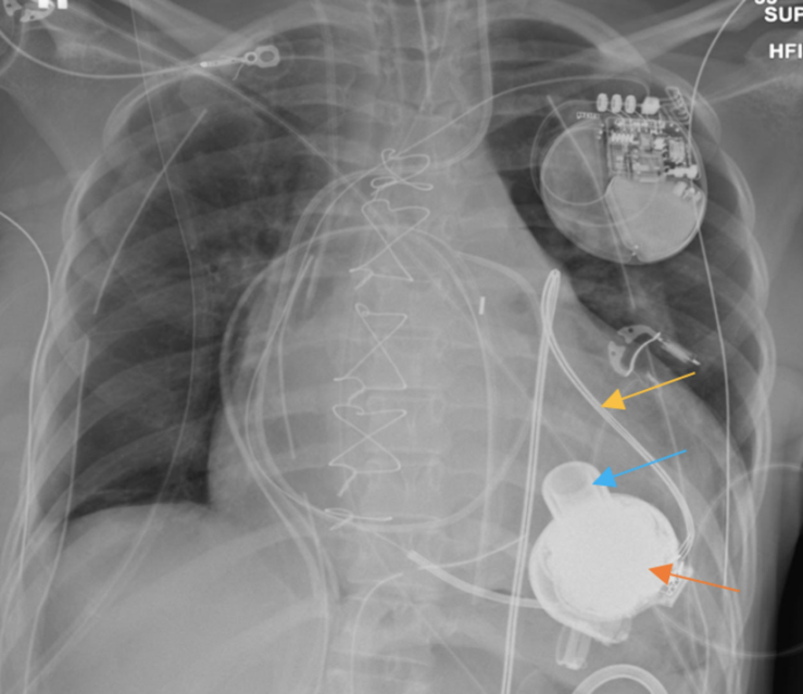 Figure 23