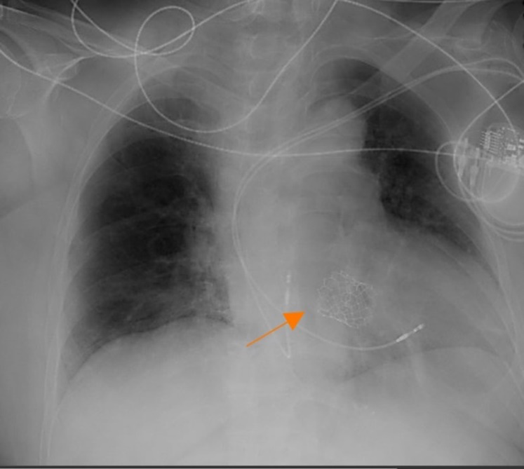 Figure 8