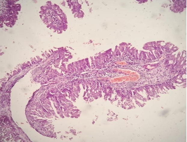 Figure 1: 10x shows respiratory epithelium.