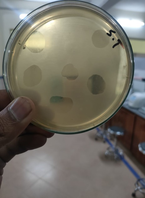 Figure 3: Different step of isolation and purification of phages.