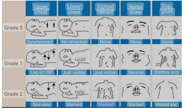 Figure 1: Intubated Baby.