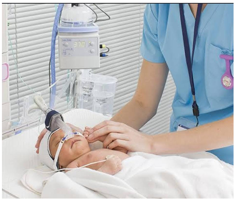 Figure 11: CPAP.