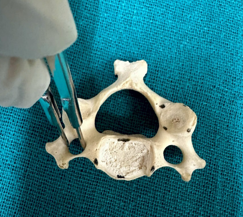 Figure 5: Bar chart showing the Length and Height of the Uncinate Process on the Left side of Typical Cervical Vertebrae.