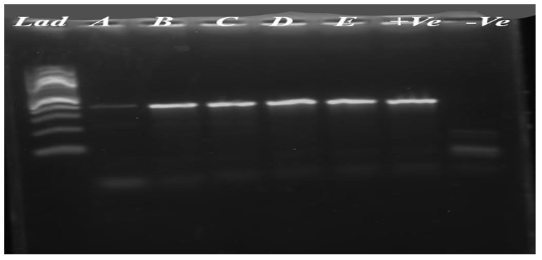 Figure 2: Representative gel pictures of invA PCR. Key: (Lad=Ladder 100bp; A, B, C, D, E= S. enterica positive isolates, +ve=Positive control, and –ve= Negative control).