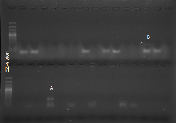 Figure 4: Cystosori Seen Under a 10X Microscope Inside the Root of _S. Tuberosum_.