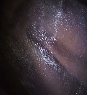Figure 4: Gentian Violet Performed on Latex Gloves, Captured in a Stereomicroscope.
