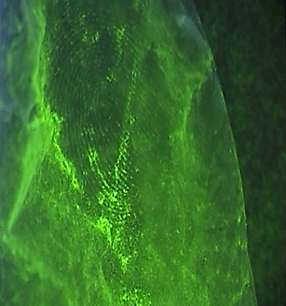 Figure 6: Sudan Black Method Used on Latex Gloves; Captured in Stereomicroscope.