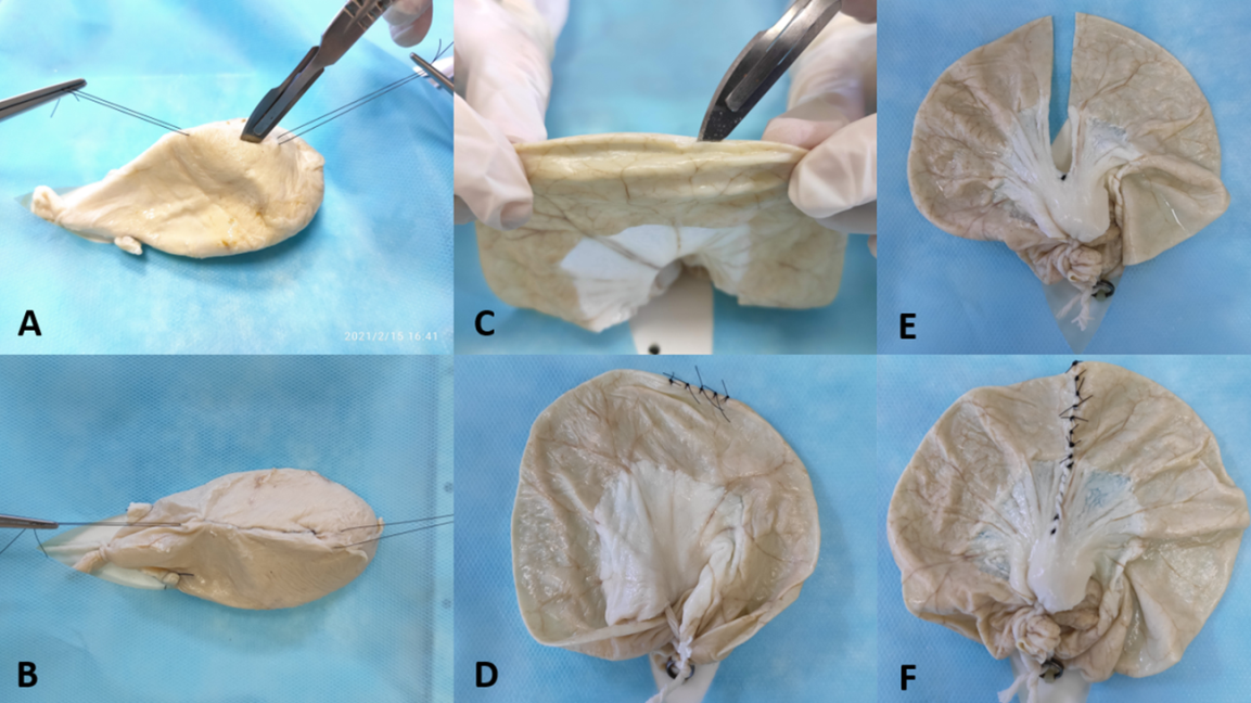 Figure 3: Operative techniques performed on the viscera. (A) Cystotomy and (B) cystotomy closure; (C) enterotomy and (D) enterotomy closure; (E) intestinal resection and (F) anastomosis.