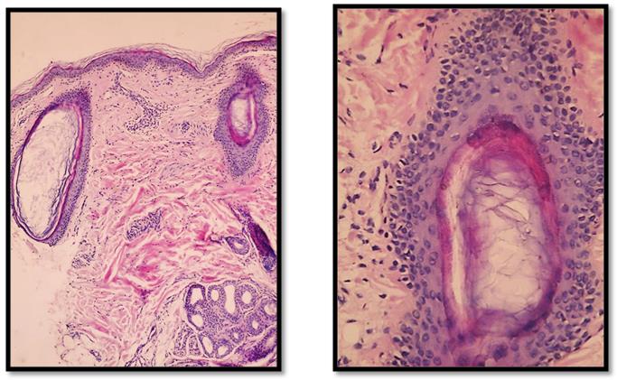 Figure 2: Clinical features before and after treatment, right lateral view.