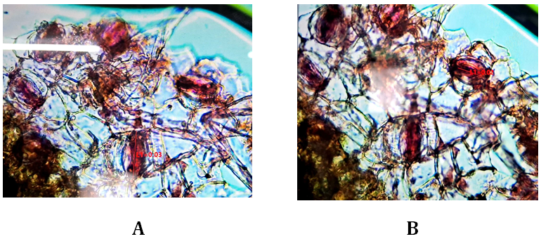 Figure 3: A: Stomatal length of leaves of S. nux-vomica L. B: Ostiolar length of leaves of S. nux-vomica L.
