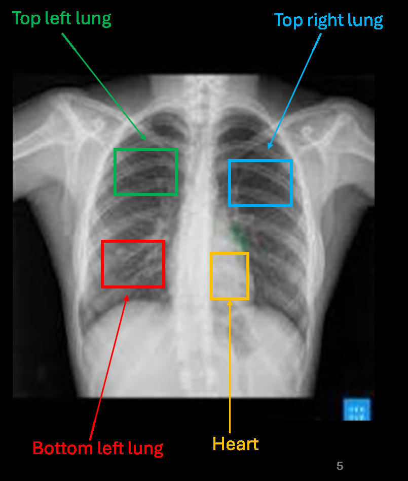 Figure 1: Diagram showing the different regions of interest (ROI) defined for this image analysis project.