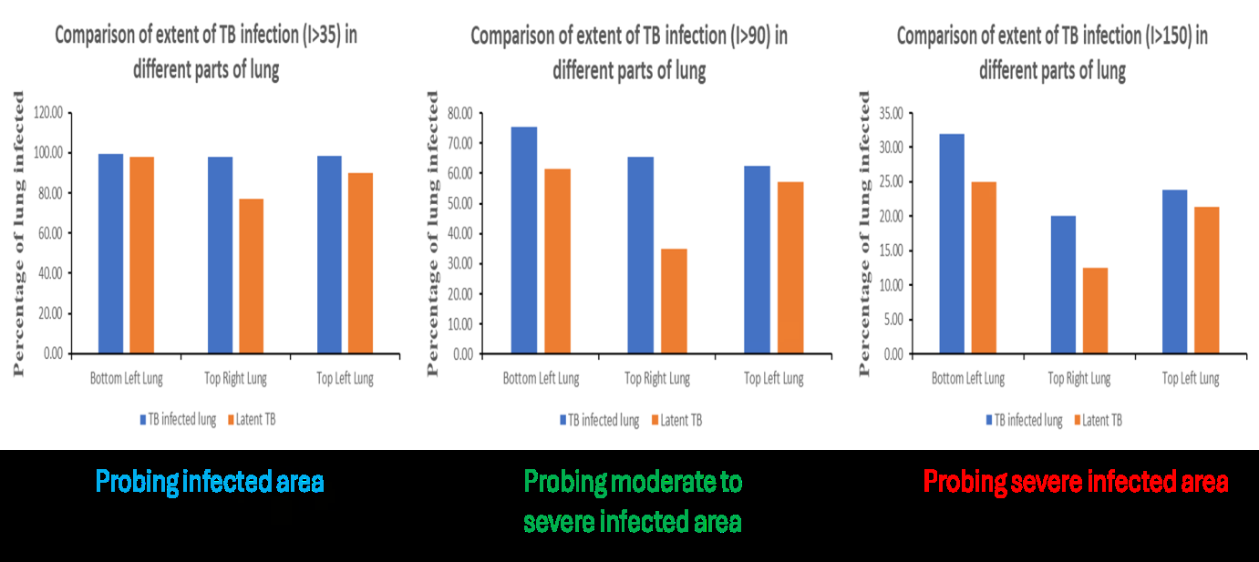 Figure 8: Comparison of extent of TB infection in different parts of lung probing infection status at (i) moderate to severe infected area and (ii) severe infected area. Results show that TB infection at (intensity > 90 and > 150) affects all regions of lung, with the top right lung being less affected.