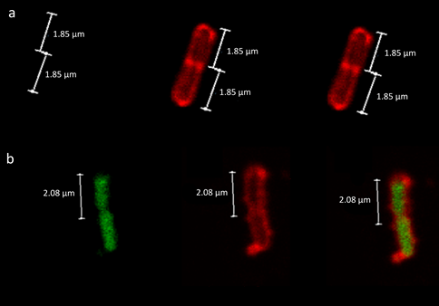 Figure 1: Biological activity against model bacterium _Escherichia coli_. Fluorescent Scanning Confocal Microscopy of _E. coli_ cells either a) untreated or b) treated with loaded nanoparticles (LNPs) containing fluorescently labelled transcriptional factor decoy (TFD). The cell walls of the samples were stained with Wheat Germ Agglutinin- Tetramethylrhodamine (WGA-TMR; Red channel, middle) and the Alexa488-labeled TFD was visualised in the Green channel (left). Merged images for each sample are shown (right).