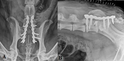 Figure 1: Postoperative radiographs of the SOP stabilization technique. Postoperative dorsoventral (A) and lateral (B) radiographs of a 3 year old spayed female Bloodhound weighing 107 lbs diagnosed with degenerative lumboscaral stenosis. The lumbosacral junction was stabilized with two seven hole 3.5mm SOP locking plates placed across the LS junction. Each plate was secured in place by two screws engaging the pedicle of L7 and three screws engaging the sacrum. The L7-S1 articular facets were stabilized with 2.7mm screws.