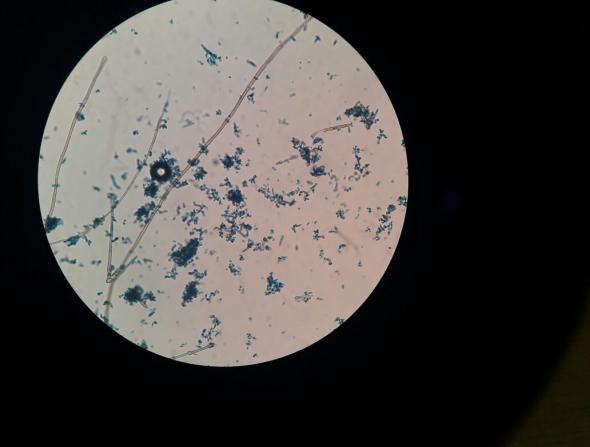 Figure 2: LPCB mount of Fonsecacea spp.