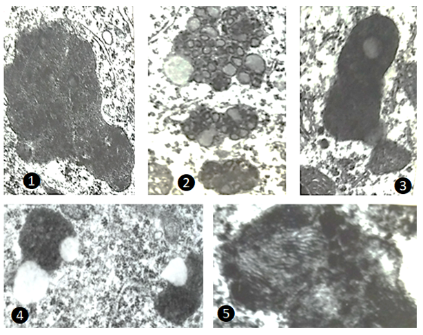 Figure 7: Proposed concept of lipofuscin formation (seen as electrondense bodies) in different parts of 24 hours restrained rats.