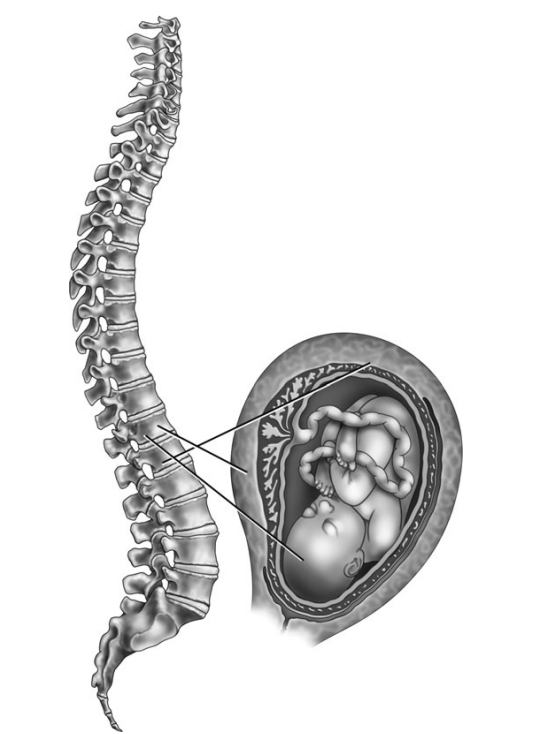 Figure 1: Labor pain results from uterine contraction, cervical dilatation, and vaginal and peroneal distention.