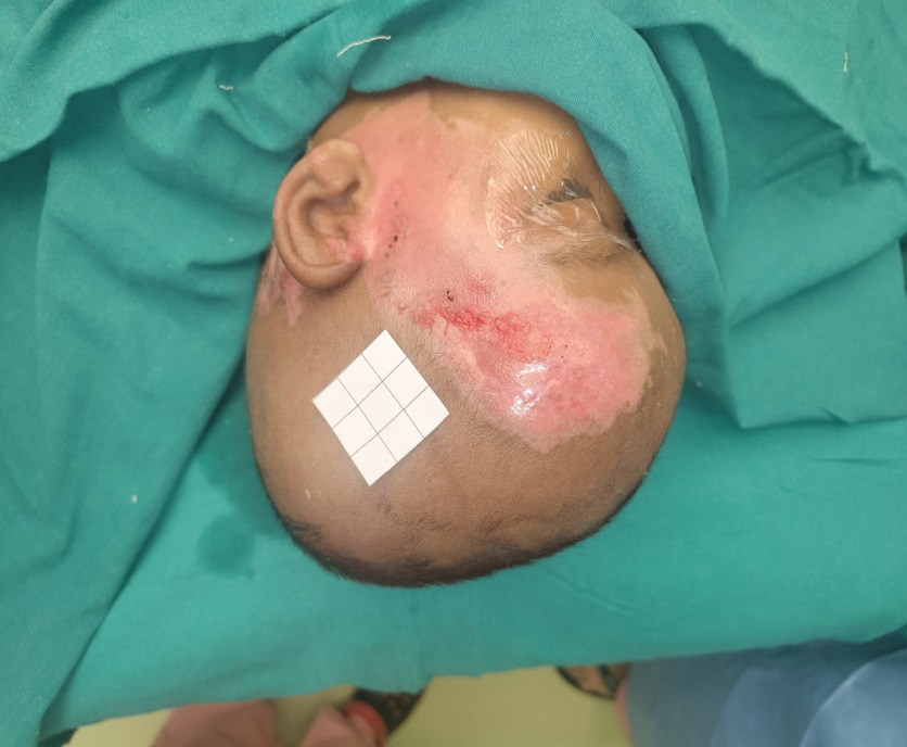 Figure 5: Partially healed wound after 7 days.