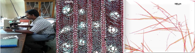 Figure 9: Microscopic Analysis of Secondary Xylem Elements for Quantitative and qualitative features.