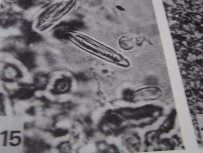 Figure 2: Three nematocysts type microbasic from acontium; b. the same nematocyst from gastric peduncle from medusae.