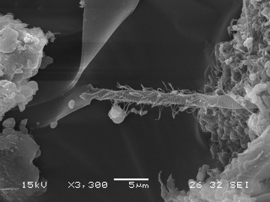 Figure 3: The tentacles are effective food traps and when they are contracted the food is wiped off on the mouth.