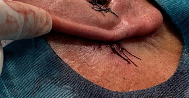 Figure 6: Posterior view of the reconstruction.