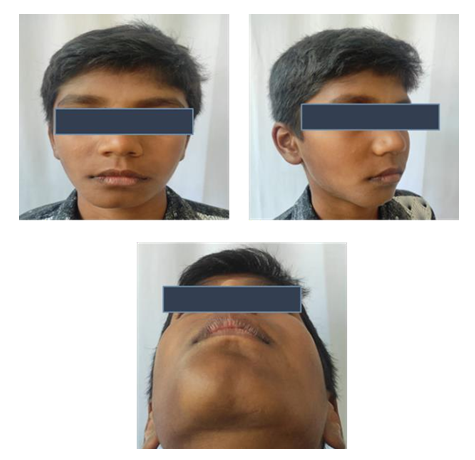Figure 1: Extra Oral Images