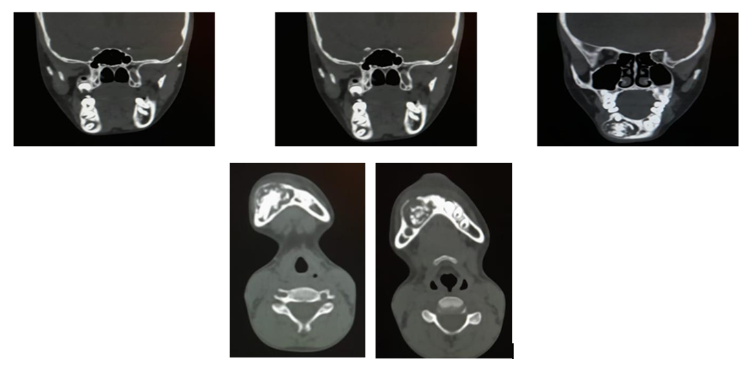 Figure 4: CT Images