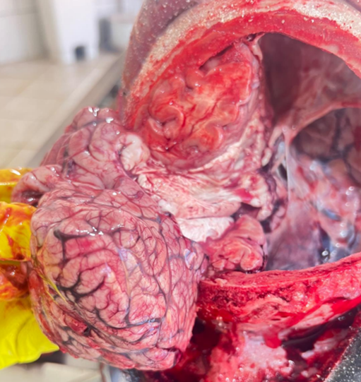 Figure 5: Unaltered Brain Parenchyma.