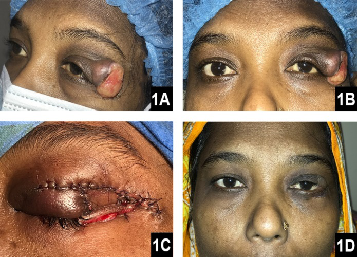 Figure 1: ** Patients picture