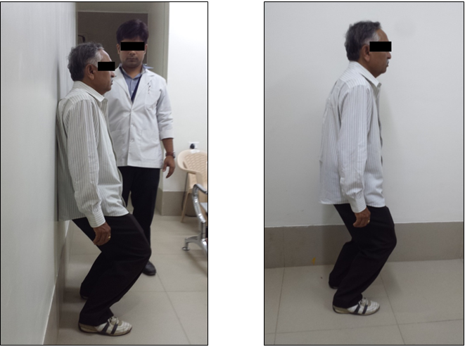 Figure 1: (Single leg stance with closed eyes).